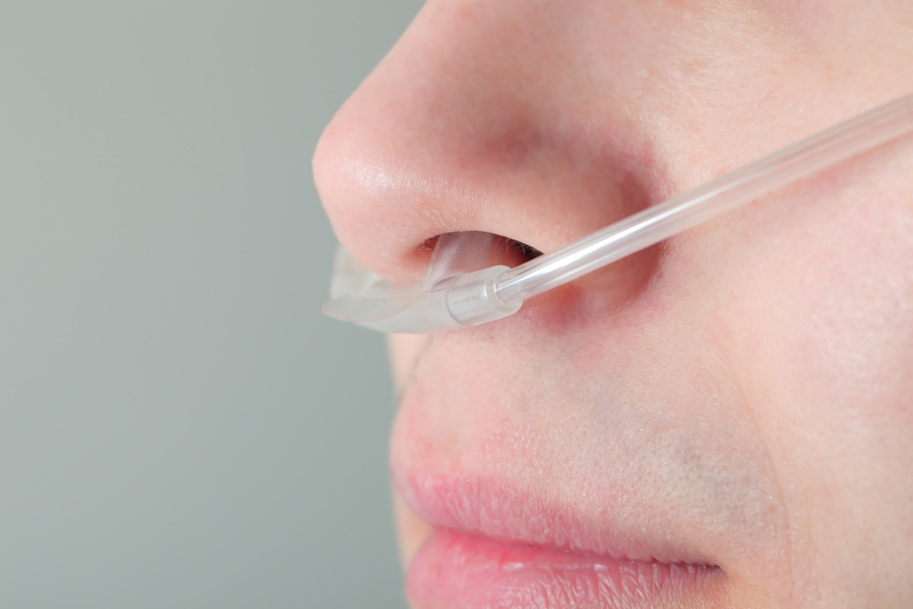 Oxygen tube in patient's nose