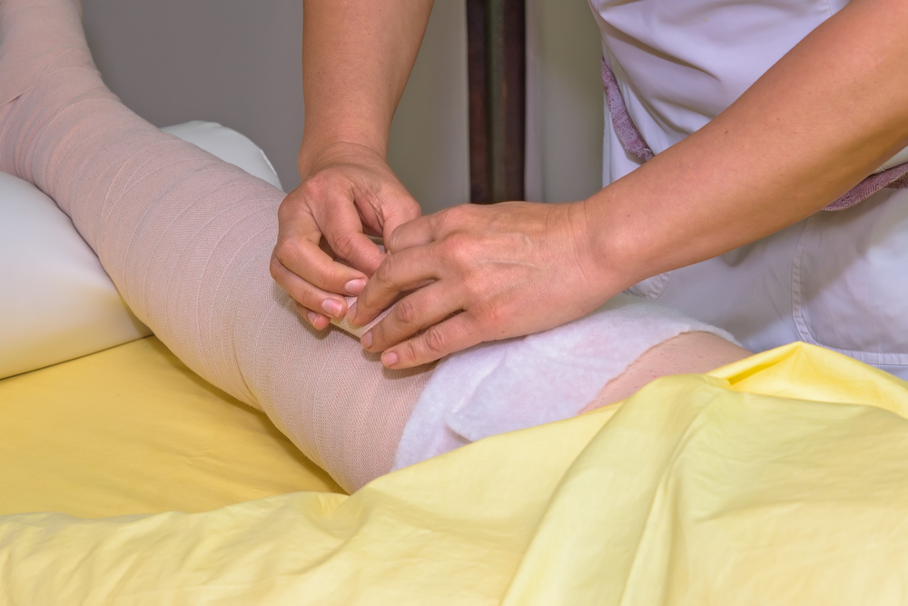 Doctor wrapping lymphedema patient's swollen leg